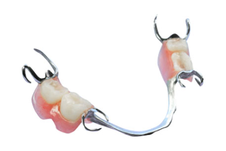 Durable Metal Partial Dentures Canberra