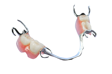 Partial Chromium Dentures Canberra - The Denture Clinic